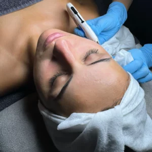 Limpieza de Cutis + Espátula Ultrasónica