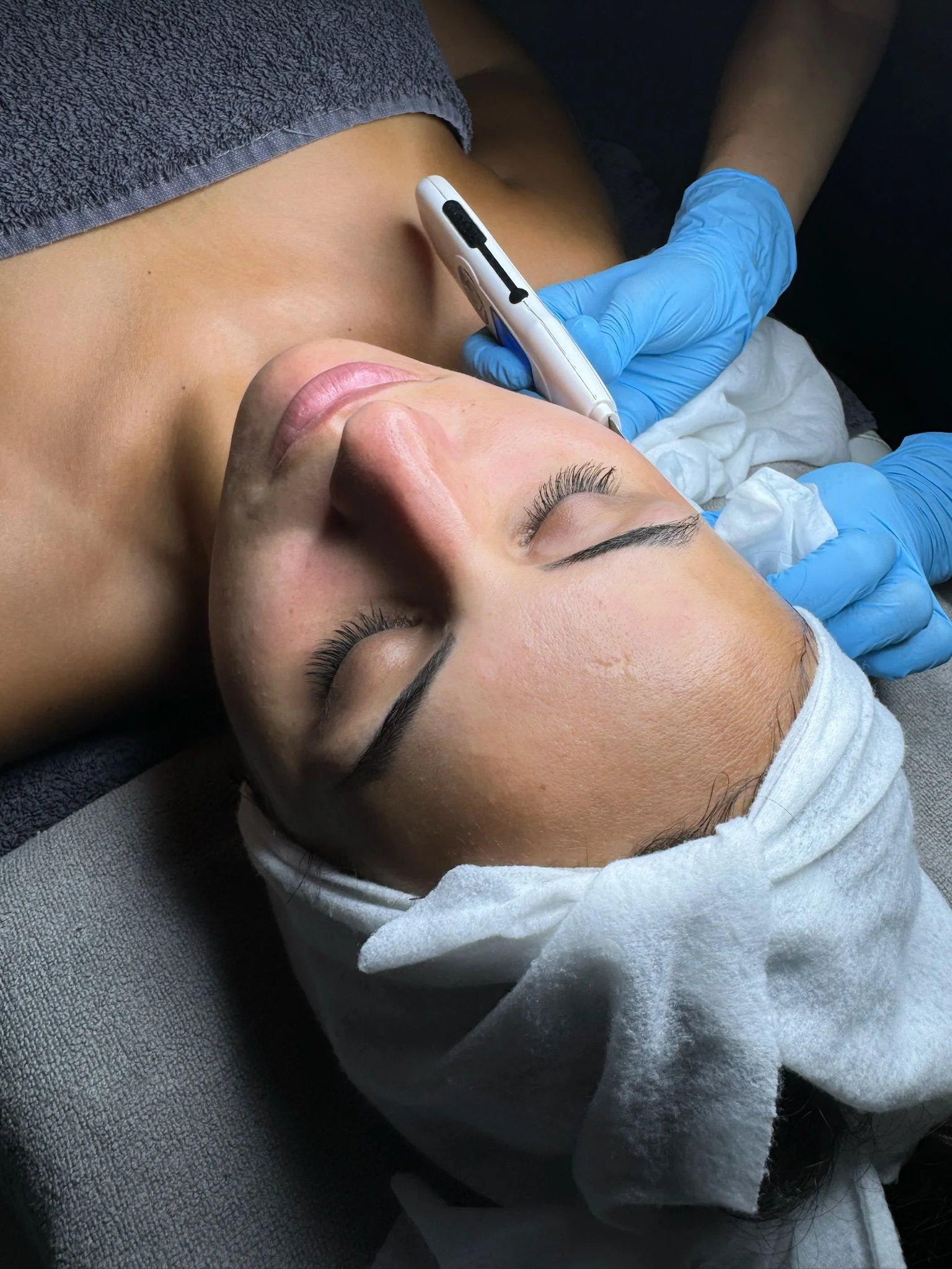 Limpieza de Cutis + Espátula Ultrasónica